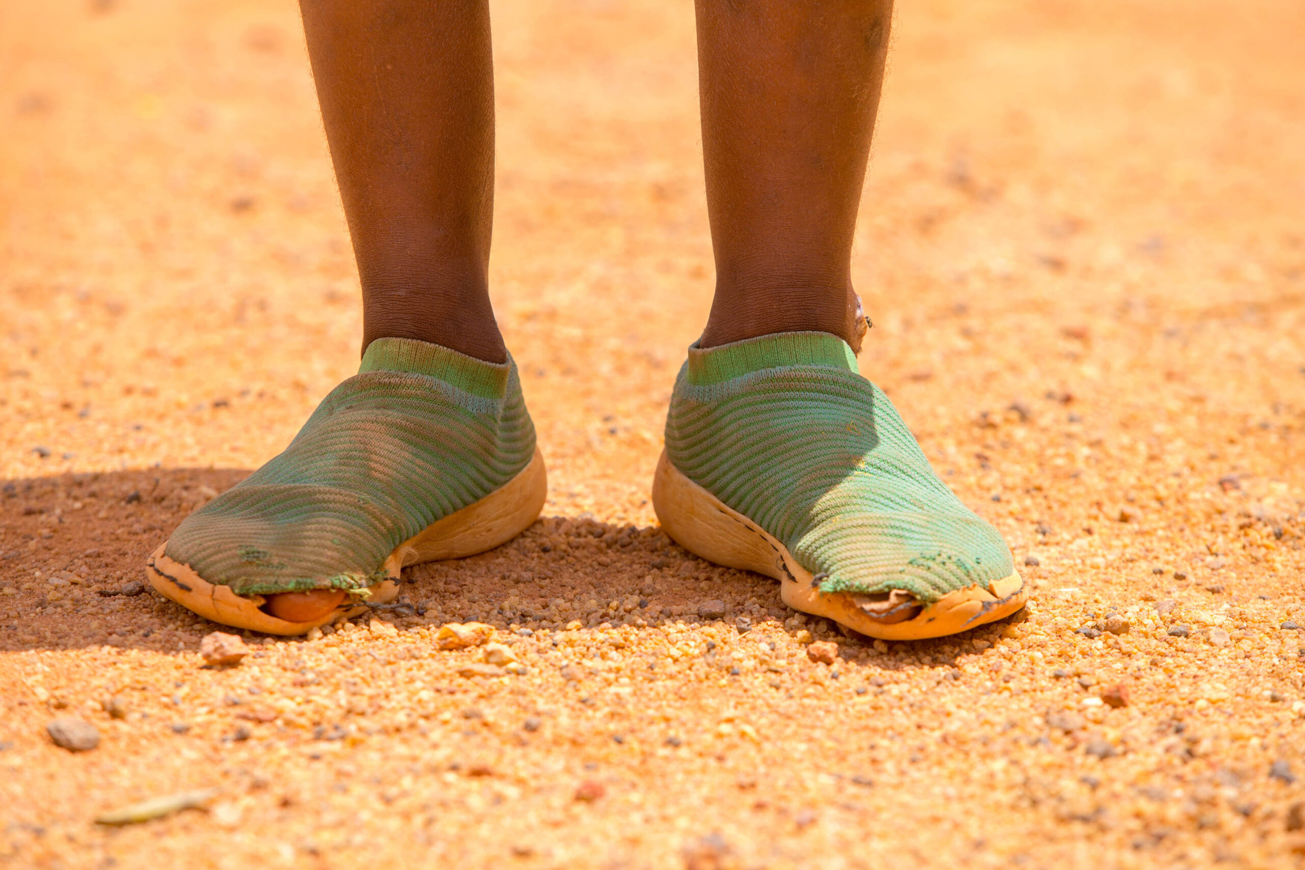 sfgh-why shoes4